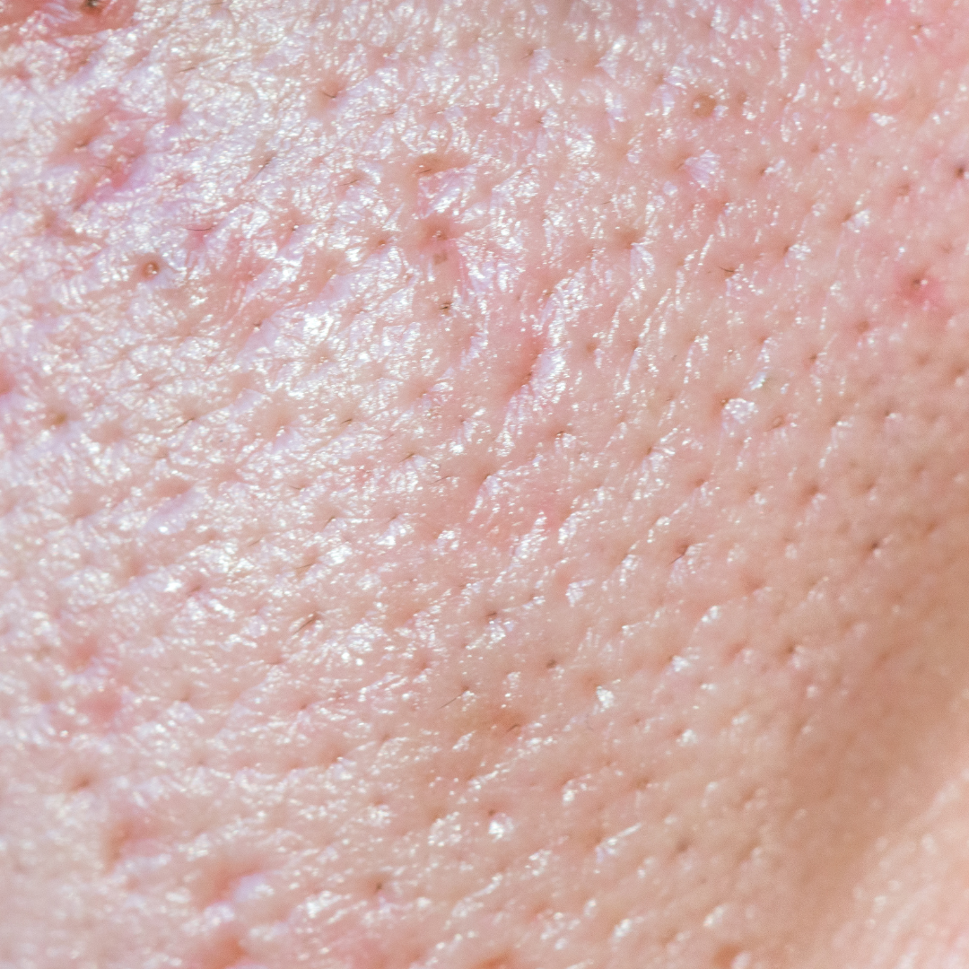 What the heck are 'pores'?